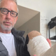 Andy Dick po pretepu z zlomljeno nogo: Bil je močnejši od mene
