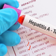 Porast hepatitisa: 'Več kot polovico okuženih nima bolezenskih znakov'