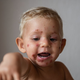 BLOG: Impetigo, bakterijska okužba kože