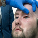 Ekipa kirurgov v New Yorku prvič uspešno presadila celotno oko