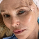 Nekdanji supermodel Christie Brinkley razkrila, da ima kožnega raka