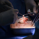 LAŽJE DOSTOPNI ORGANI: Gensko spremenjeno ledvico prašiča prvič presadili živemu človeku (VIDEO)