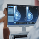 V ZDA na mamografijo že 40-letnice. Bodo starostno mejo znižali tudi pri nas?