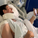 Alex Marquez uspešno prestal operacijo ključnice