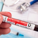 Testiranje kot ključen ukrep proti hepatitisom