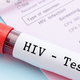 HIV-pozitivnega pacienta javno izpostavila in si nadela rokavice