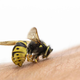 Čebelar razkriva: kaj morate storiti takoj, ko vas piči čebela?