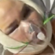 Vplivnež zaradi popolnega obraza začasno oslepel