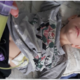 Gastrostoma mlademu Lovru iz Koroške in ostalim bolnikom rešuje življenje