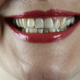 Kaj razkriva barva zob o našem zdravju?