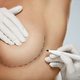 Povečanje prsi: 10 stvari, ki jih morate vedeti