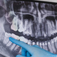 Izraščanje zob včasih ne poteka pravilno, zato je potreben zdravniški poseg
