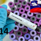 V Sloveniji od sobote 31 dodatnih okužb z novim koronavirusom, skupaj 414 okuženih