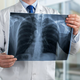 Bo presejalni program lahko preprečil petino vseh smrti zaradi pljučnega raka?