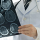 Medicinska sestra trdila, da možganske kapi niso prepoznali