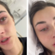 Znana Slovenka pretresena nad obravnavo na Infekcijski kliniki: »Štiri ure sem čakala na hodniku, potem pa so mi rekli: 'Saj si mlada, boš prebolela'« (VIDEO)