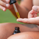 Razmišljate o CBD-ju med kemoterapijo? To morate vedeti pred prvim odmerkom