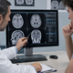 Videti je kot možganski tumor, a diagnoza lahko preseneti