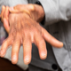 Za Parkinsonovo bolezen ni enega testa: kako jo zdravniki odkrijejo?