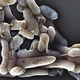 NIJZ: Največ okužb s kampilobaktrom in salmonelo zabeležili v Pomurju