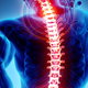 Tako si lahko pomagate lajšati bolečine v hrbtu