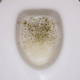 8 razlogov, zakaj imate penast urin