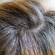 Razlogi, zakaj lasje prezgodaj sivijo