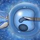 Vse, kar morate vedeti o IVF