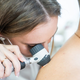 Slovenski dermatologi pozivajo k strožji zaščiti pred UV-sevanjem: ''Vsako leto odlašanja pomeni nove bolnike''