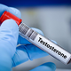 Testosteron in hormoni po 40. letu