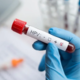 Državni program Zora bo uvedel sodobnejši test HPV