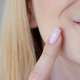 Zakaj se suha koža okoli ust pojavi poleti in kako to preprečiti?