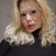 Je to ženska z največjimi ustnicami na svetu?