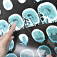 Skrivnost srednje šole: Skoraj sto oseb z redkim možganskim tumorja